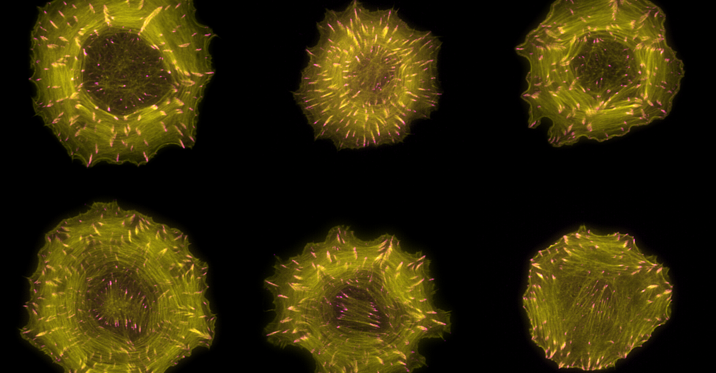 Mikroskopaufnahmen von Zellen, in denen Aktinfasen des Zellskeletts gelb und fokale Adhäsionen pink gefärbt sind. (© Markus Müller, Rocks Lab, MDC)