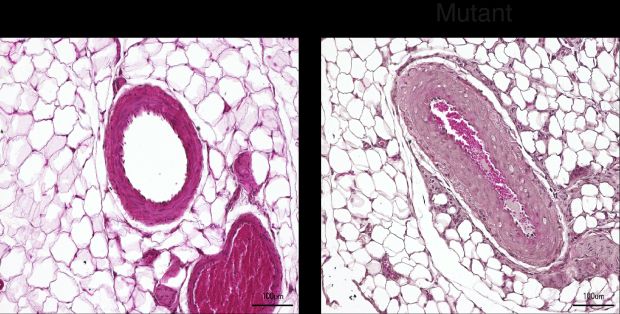 Verengte Mesenterialarterien bei Ratten mit mutiertem PDE3A-Gen (rechts) verursachen durch Erhöhung des Widerstandes den Blutdruck. (Foto: Dr. Q. Fatimunnisa, Bader Lab, MDC)