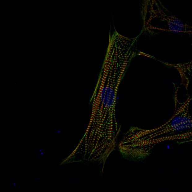 Menschliche Herzmuskelzellen, die aus induzierten pluripotenten Stammzellen entstanden sind. (Foto: Sebastian Diecke, MDC)
