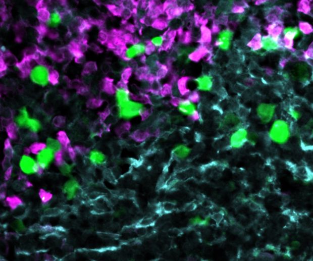 Die gegen CXCR5 gerichteten CAR-T-Zellen (grün) greifen Lymphom-Zellen (rot) innerhalb des Stroma-Zellnetzwerks im B-Zell-Follikel an (hellblau). (Foto: AG Höpken)