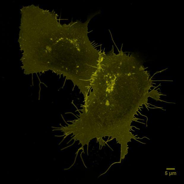Zwei embryonale Nierenzellen, die den CXCR4-Rezeptor ausbilden (in dunkelgelb). Bild: Paolo Annibale, Ali Isbilir, MDC
