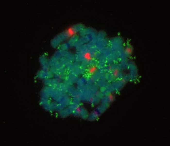 Erbinformation einer Neuroblastomzelle mit DNA-Ringen. Foto: Henssen/Charité
