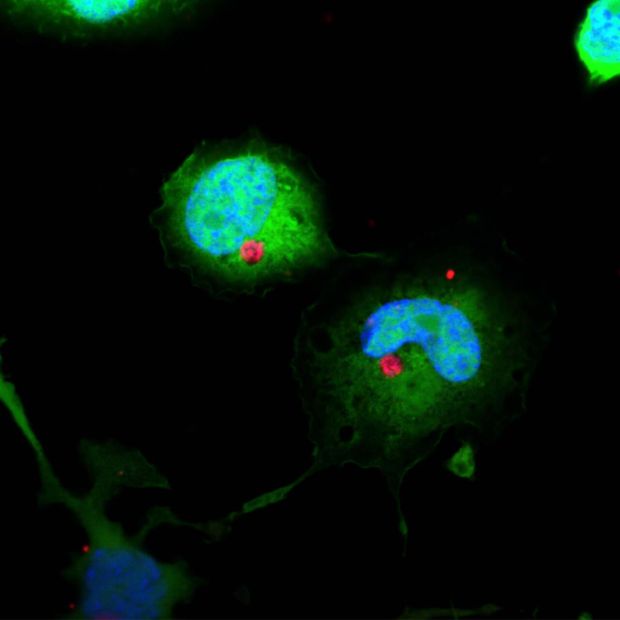 THP-1 (GBP1 knock-out) Makrophagen infiziert mit Chlamydien. Die Zellkerne der Immunzellen sind blau und die Chlamydien rot dargestellt. © Audrey Xavier, MDC