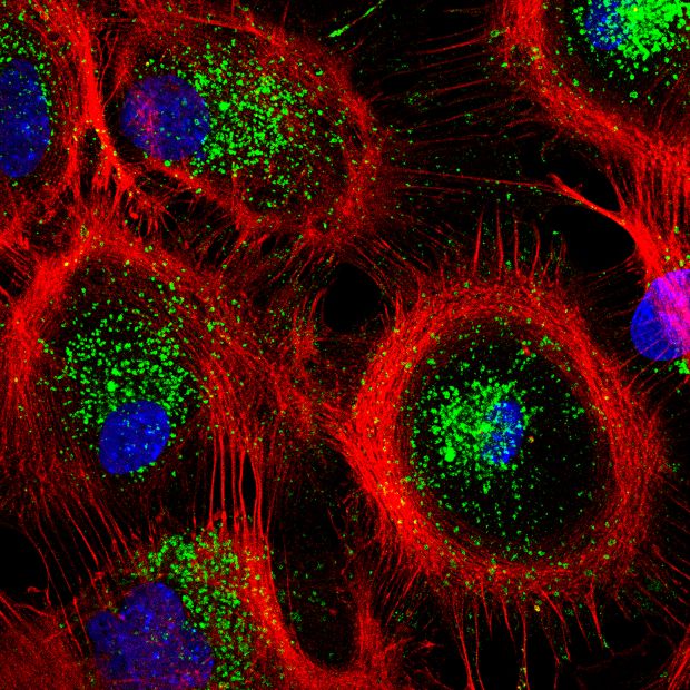 Image of mouse astrocytes showing the actin cytoskeleton (red) and lysosomes (green). (Image: Tania Lopez-Hernandez)