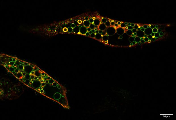 Mikroskopische Aufnahme zweier Zellen, die die krankheitserzeugende Mutante von ClC-6 (rot markiert) überproduzieren. (Bild: Carlo Barbini)