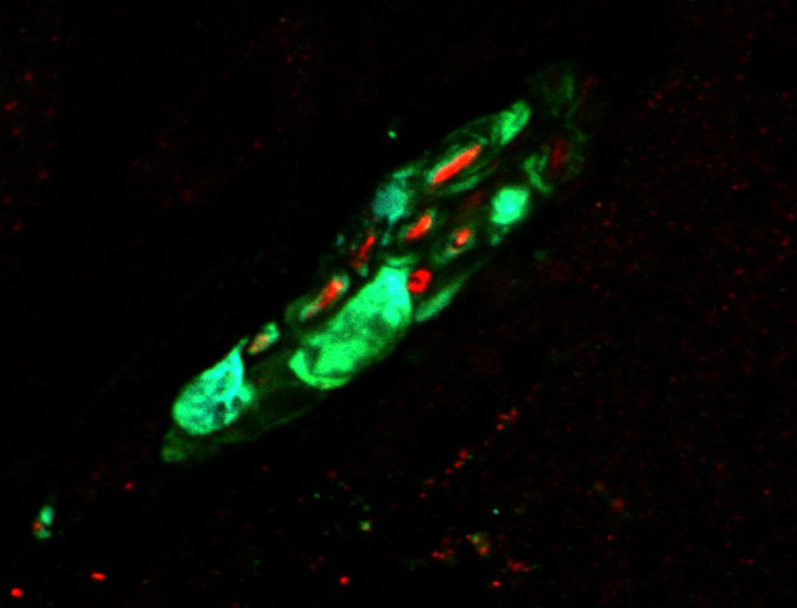 Hochauflösendes Bild des hervorgehobenen Meissner-Rezeptors mit dem USH2A-Protein (grün) und einem sensorischen Axon (rot). © Lewin Lab, MDC