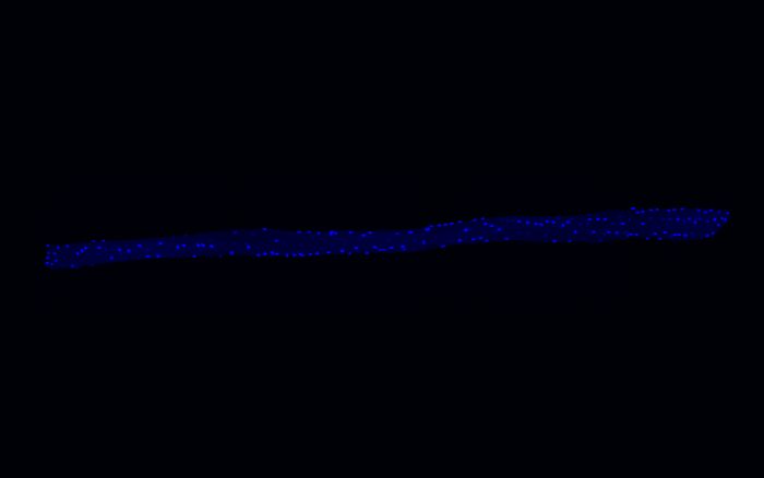 Bei dieser einzelnen Muskelfaser kann man deutlich eine Vielzahl von Kernen erkennen.Die Forscher*innen haben DAPI zur Färbung benutzt, es färbt die DNA im Zellkern blau (Foto: AG C. Birchmeier)