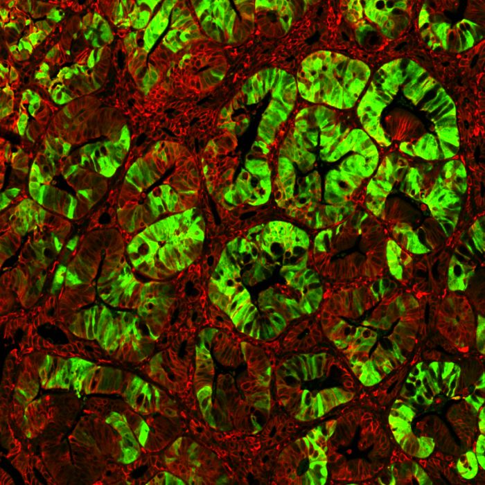 Expandierende Krebsstammzellen (grün) in einem Darmtumor mit onkogen aktiviertem Wnt/beta-Catenin Signalweg (rot). (Bild: AG W. Birchmeier, MDC)