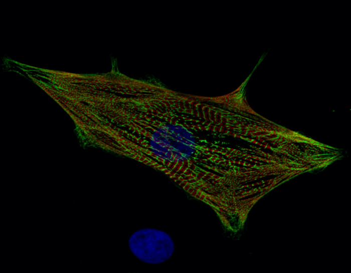 Menschliche Herzmuskelzelle die aus induzierten pluripotenten Zellen (hIPSCs) hergestellt wurde (Foto: Sebastian Diecke/MDC)