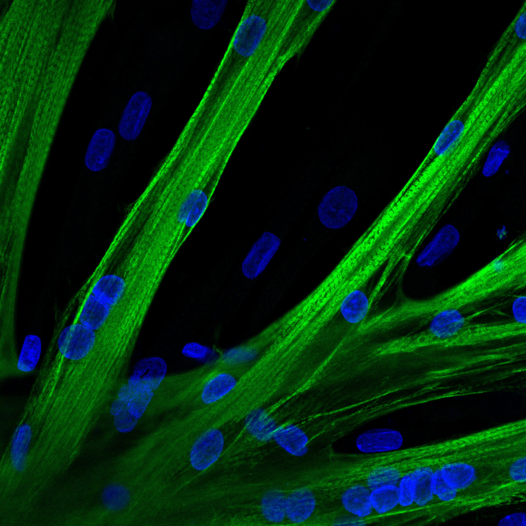 Nach der Genomeditierung verschmolzen die Stammzellen zu mehrkernigen Fasern (Myotuben). In grün ist eine schwere Kette Myosin zu sehen; in blau die Zellkerne. (Foto: AG Spuler)