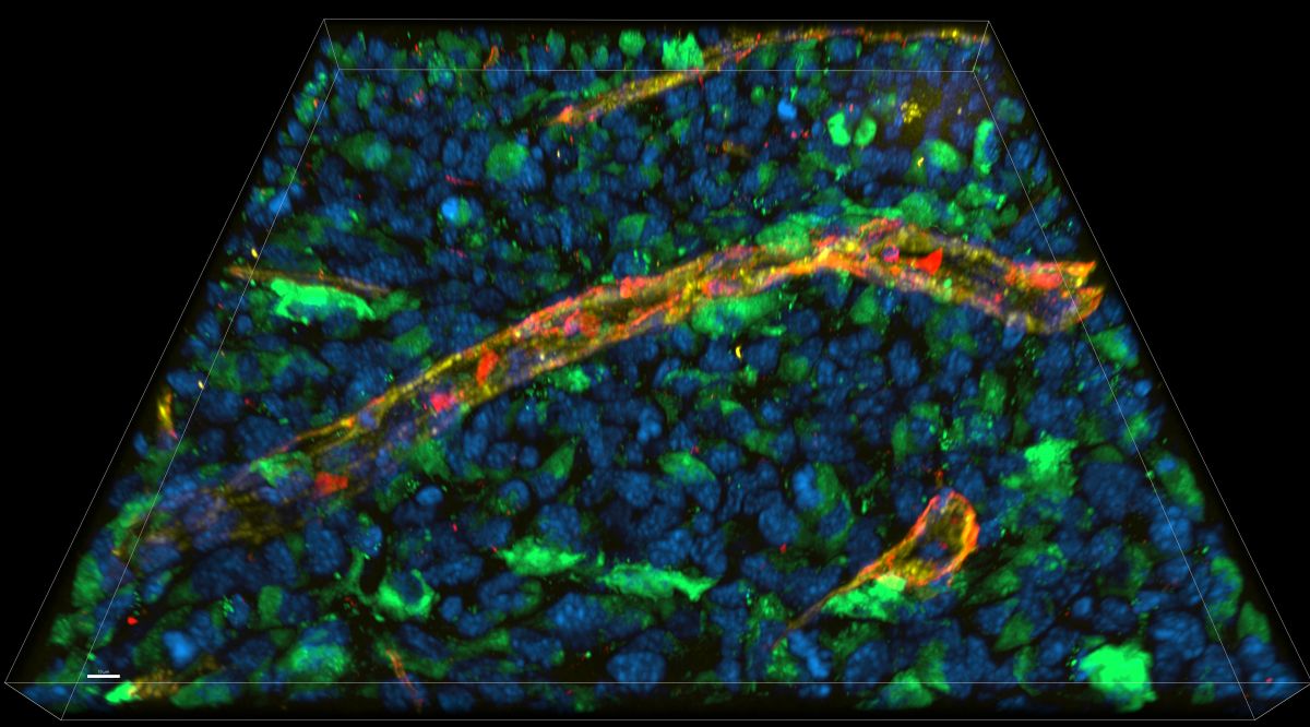 © AG Blankenstein, Technologieplattform „Advanced Light Microscopy“, Max Delbrück Center