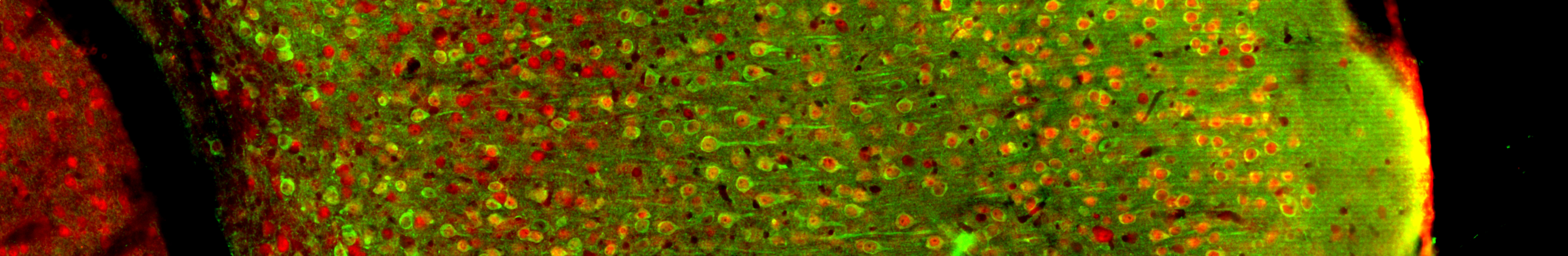Epifluoreszenzbild der hinteren Inselrinde der Maus: Die Neuronen exprimieren ein kalziumempfindliches Protein grün und einen allgemeinen neuronalen Marker rot. Foto: Mikkel Vestergaard, AG Poulet, Max Delbrück Center