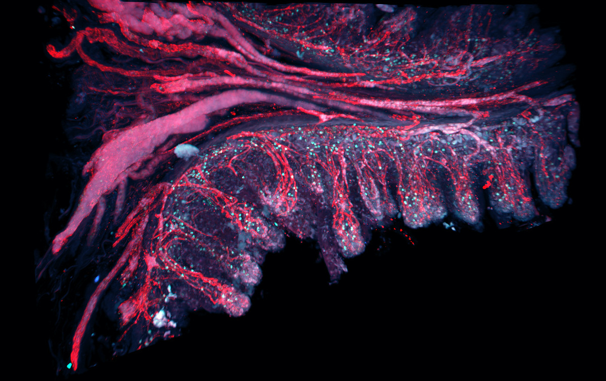Mikroskopische Aufnahme der Darmschleimhaut: Die Blutgefäße sind rot dargestellt, die T-Zellen sind türkis. Foto: René Hägerling, BIH/Charité