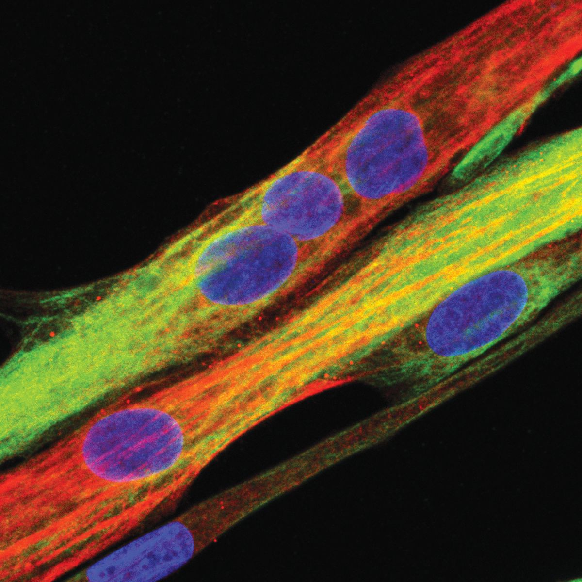 Menschliche_Muskelzelle-aus Muskelstammzellen differenziert (Abb.: Max Delbrück Center)