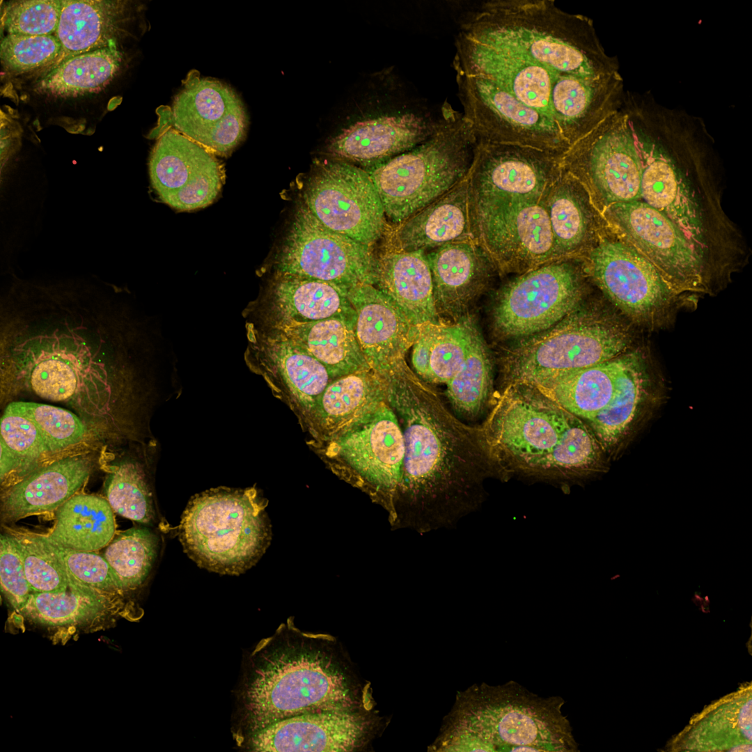 Mit Fluoreszenz markierte Zellkerne, Mitochondrien und Aktinfilamente. Foto: Screening Unit / FMP