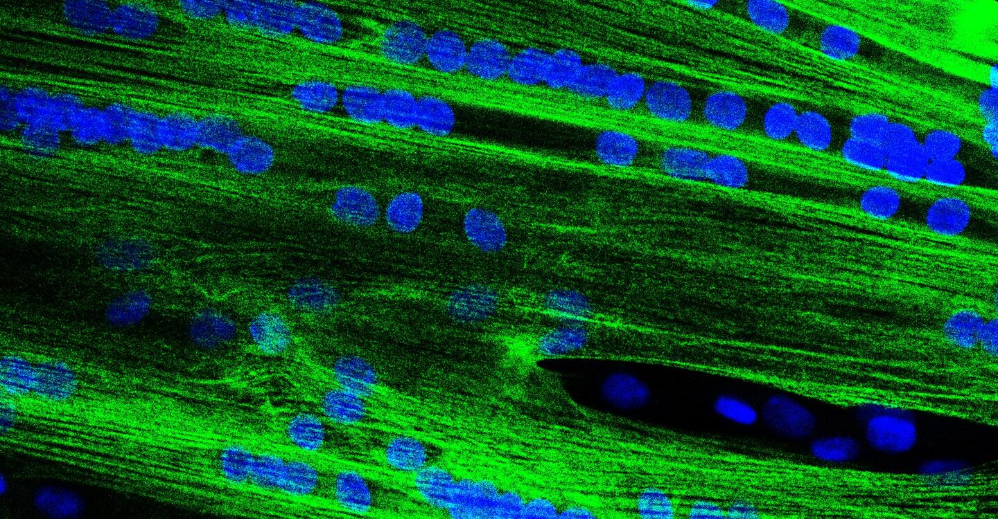 Fused muscle cells (Image: Dr. Eric Metzler, MyoPax)