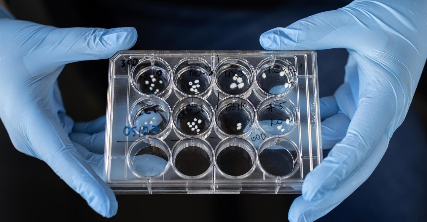 Foto: Pablo Castagnola/Einstein Stiftung